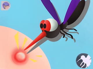 Mosquito Bite 3D